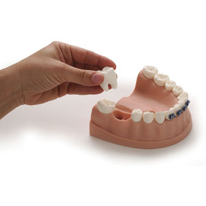 orthodontic model