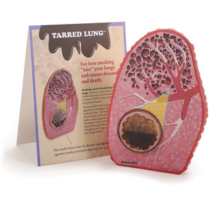 lung model