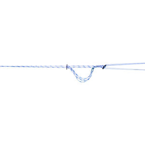 ACL reconstruction suture button