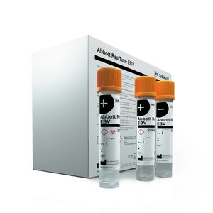 DNA quantification assay kit / for Epstein-Barr virus / plasma / whole blood
