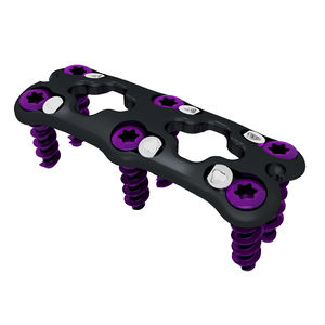 cervical arthrodesis plate