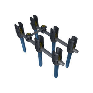 thoraco-lumbar arthrodesis plate