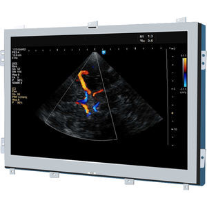 ultrasound imaging display