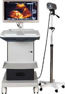 digital colposcope