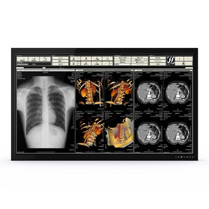 medical monitor