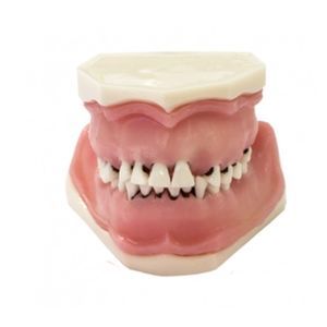 tooth model