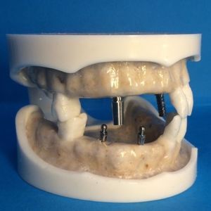 gingival anatomical model