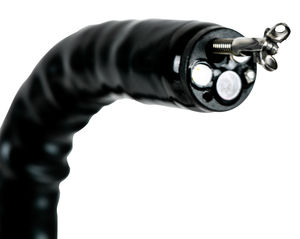 video gastroscope