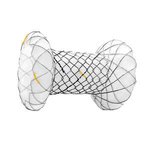 pancreatic stent