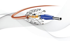 peripheral stent