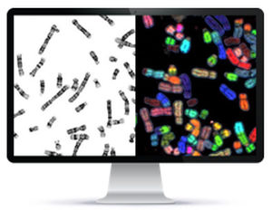 automatic cell imaging system