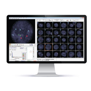 automatic cell imaging system
