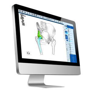 analysis software / treatment / simulation / planning