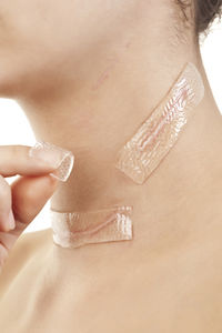 wound dressing