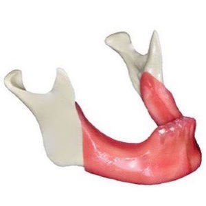 bone model 1