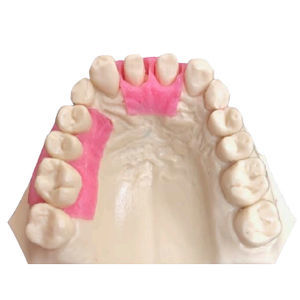 dental model