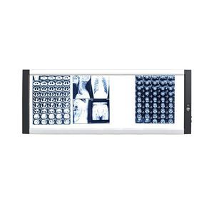 4-screen X-ray film viewer