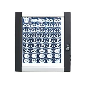 1-screen X-ray film viewer 1