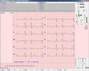 ECG software module