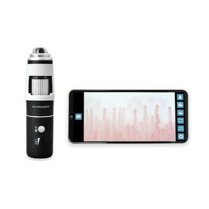 video capillaroscope