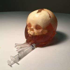 ultrasound imaging test phantom