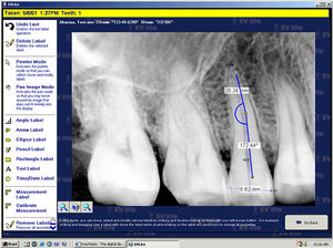 dental imaging software