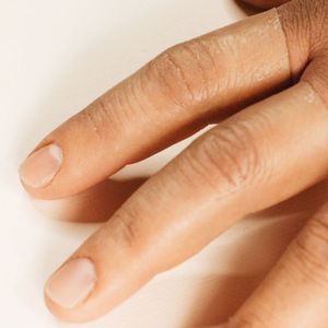 finger cosmetic prosthesis