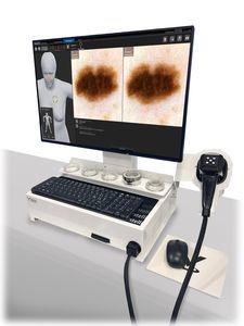 video dermatoscope 1
