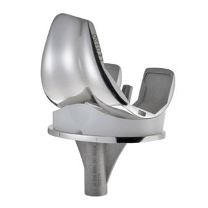 mobile-bearing knee prosthesis / cemented or non-cemented