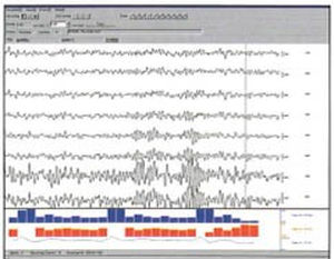 EMG software