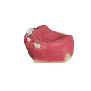 dental model 1