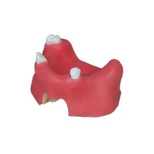 dental model 1