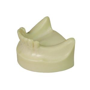 dental model 1
