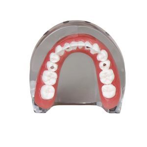 mandible model 1