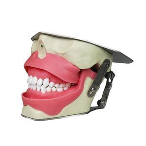 dental model 1