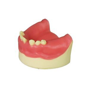 dental model