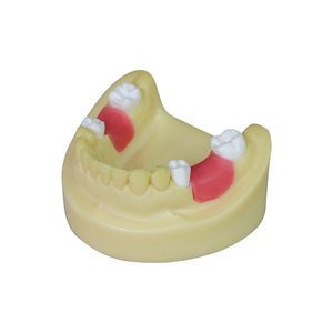 dental model 1