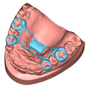 dental laboratory software