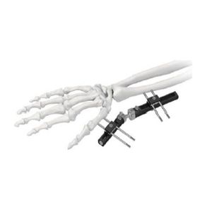 wrist external fixation system