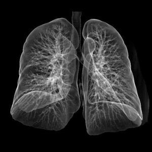 multipurpose radiography X-ray film 1