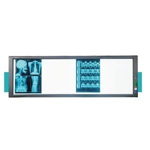 adjustable brightness X-ray film viewer