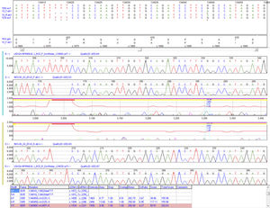 DNA sequencing software