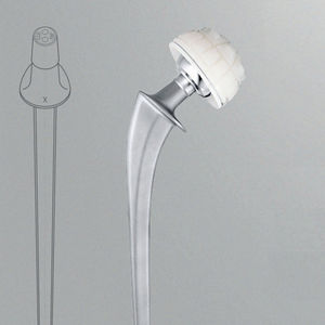 primary hip prosthesis / cemented