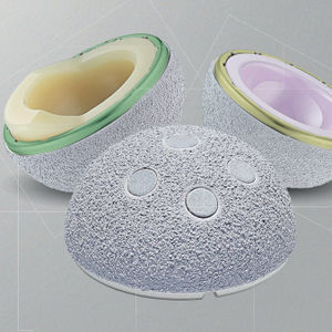 cementless acetabular prosthesis