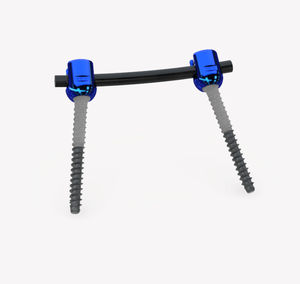 lumbar spinal osteosynthesis unit