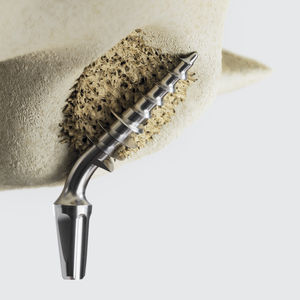 cylindrical dental implant