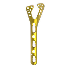 radius compression plate