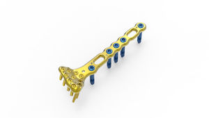 wrist compression plate