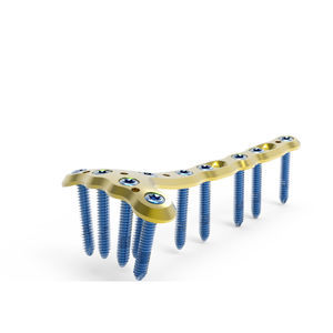 tibia compression plate