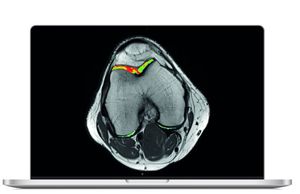 MRI software